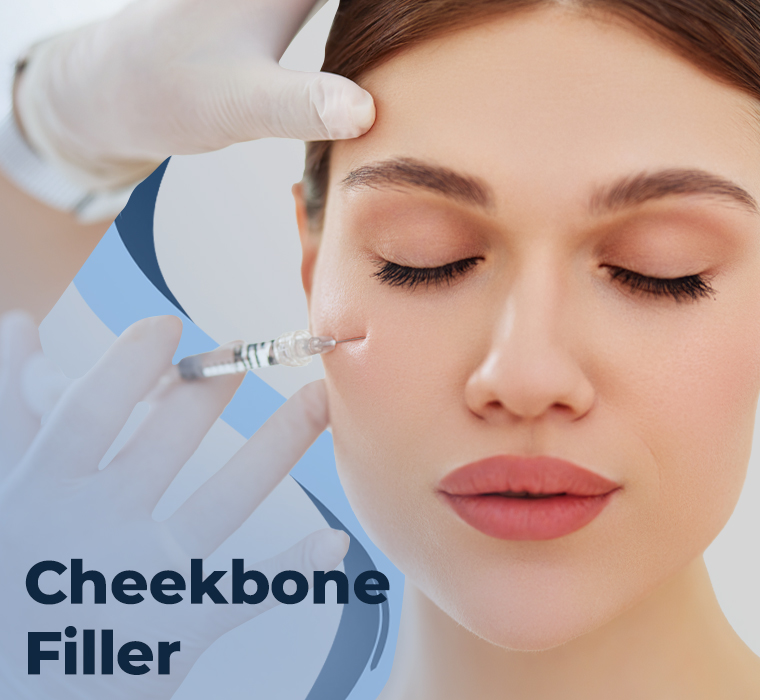 Cheekbone Filling